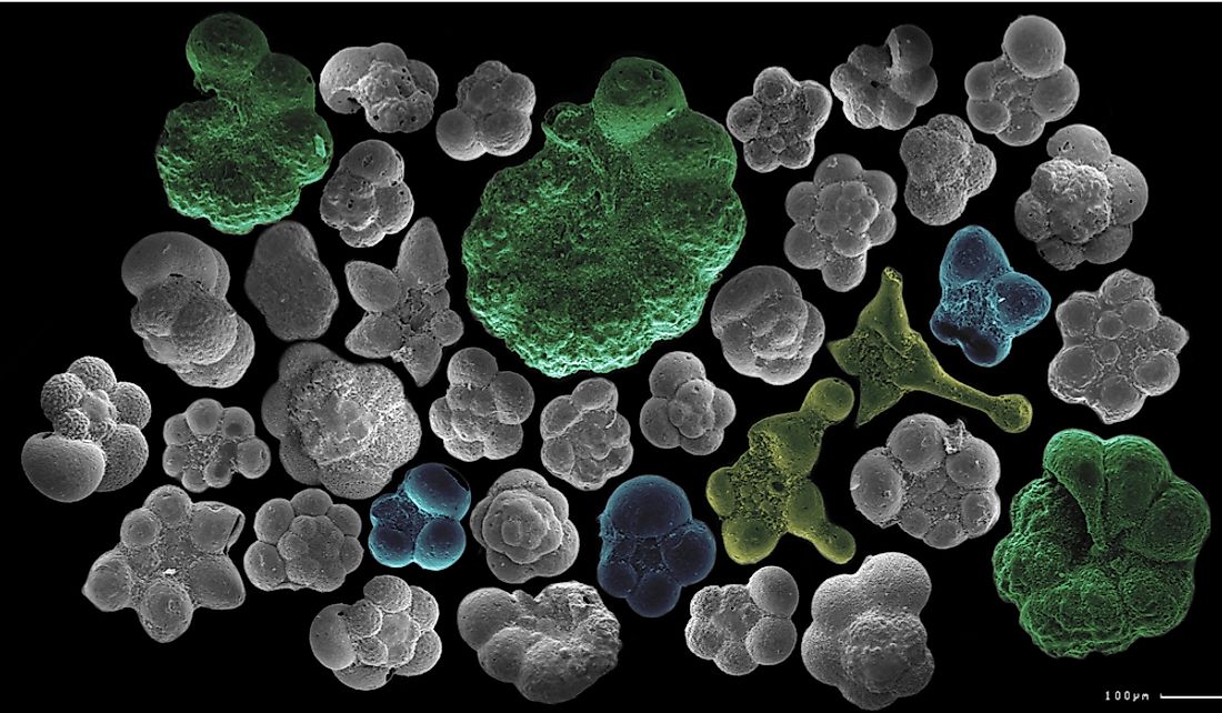 protozoa-definition-characteristics-classification-examples