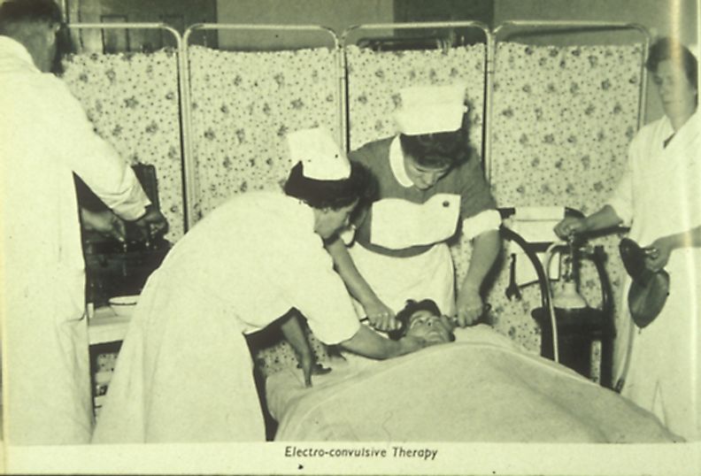 1957 electroconvulsive therapy