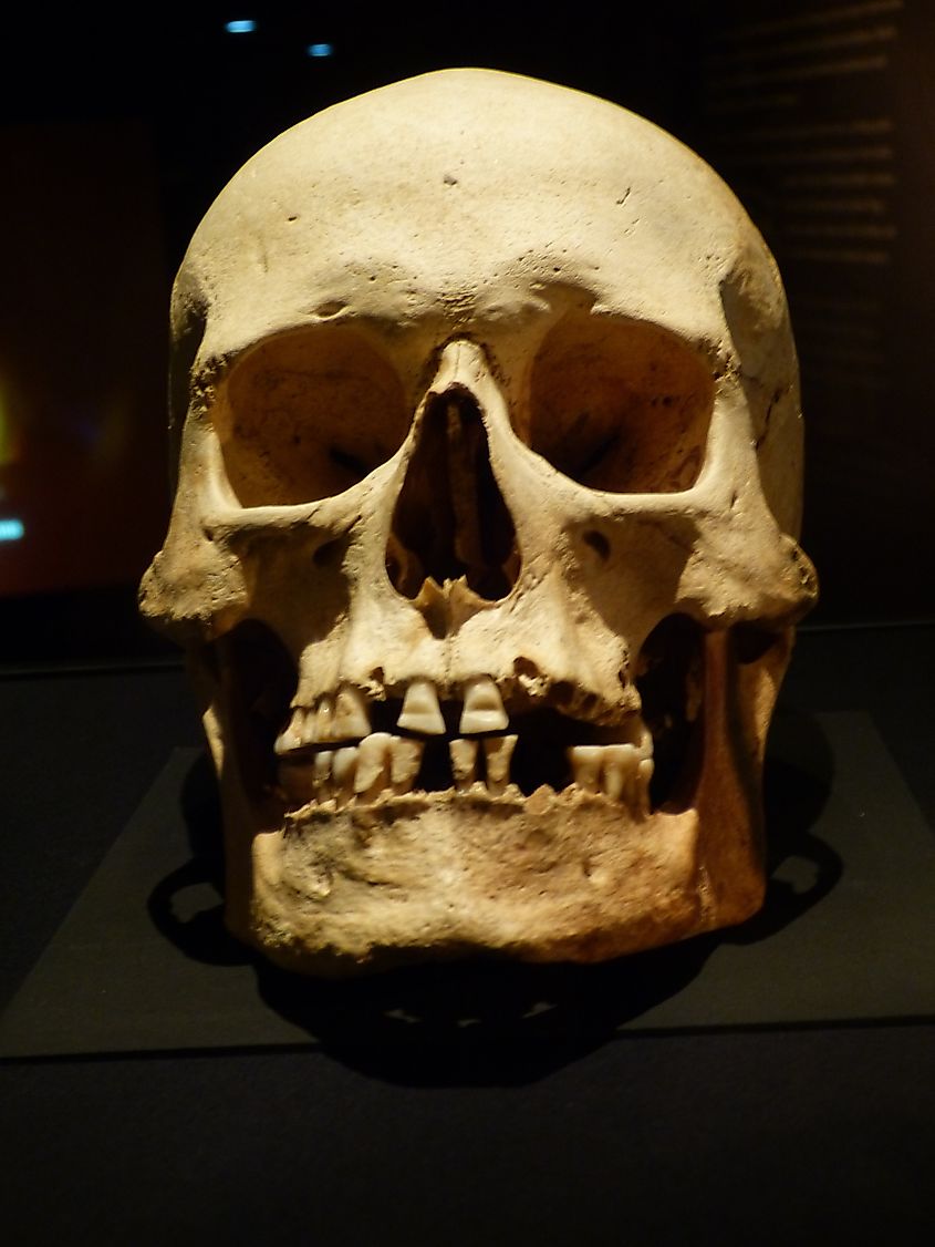 A viking skull with notched teeth.