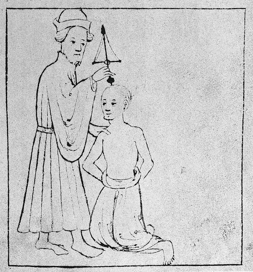 13th century Trepanation